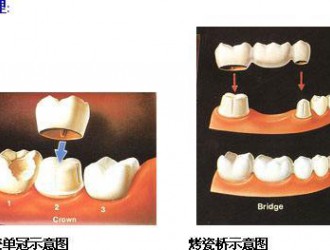 口腔治療中的騙局都有哪些？這些坑不要踩！