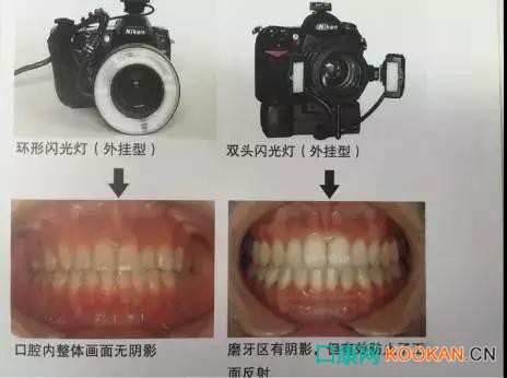 拍不好口腔照片怎么辦？這些口腔攝影方法與技巧請收好！