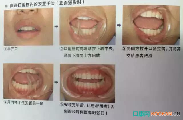 拍不好口腔照片怎么辦？這些口腔攝影方法與技巧請收好！