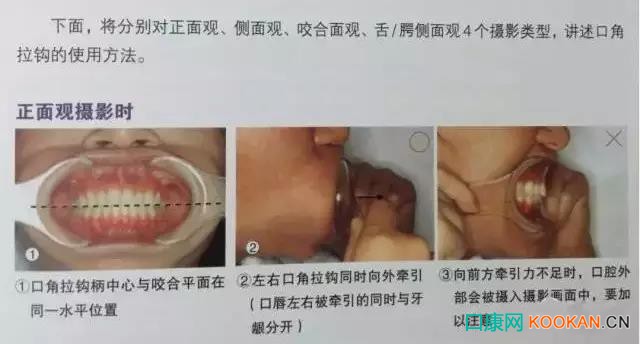 拍不好口腔照片怎么辦？這些口腔攝影方法與技巧請收好！