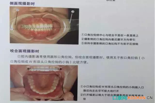 拍不好口腔照片怎么辦？這些口腔攝影方法與技巧請收好！