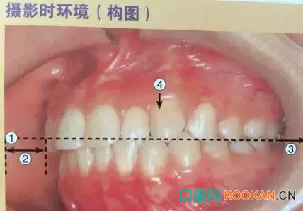 拍不好口腔照片怎么辦？這些口腔攝影方法與技巧請收好！