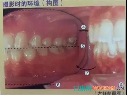 拍不好口腔照片怎么辦？這些口腔攝影方法與技巧請收好！