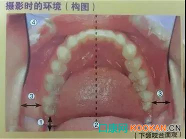 拍不好口腔照片怎么辦？這些口腔攝影方法與技巧請收好！