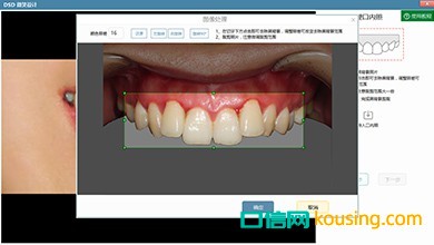 DSD美學微笑設計口腔管理軟件工具多樣調試